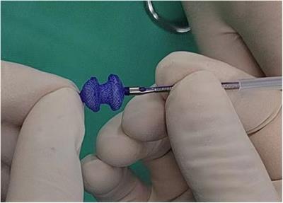 The 3-year follow-up of a fully biodegradable implantable device closure for perimembranous ventricular septal defects in children using echocardiography